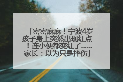 密密麻麻！宁波4岁孩子身上突然出现红点！连小便都变红了……家长：以为只是摔伤